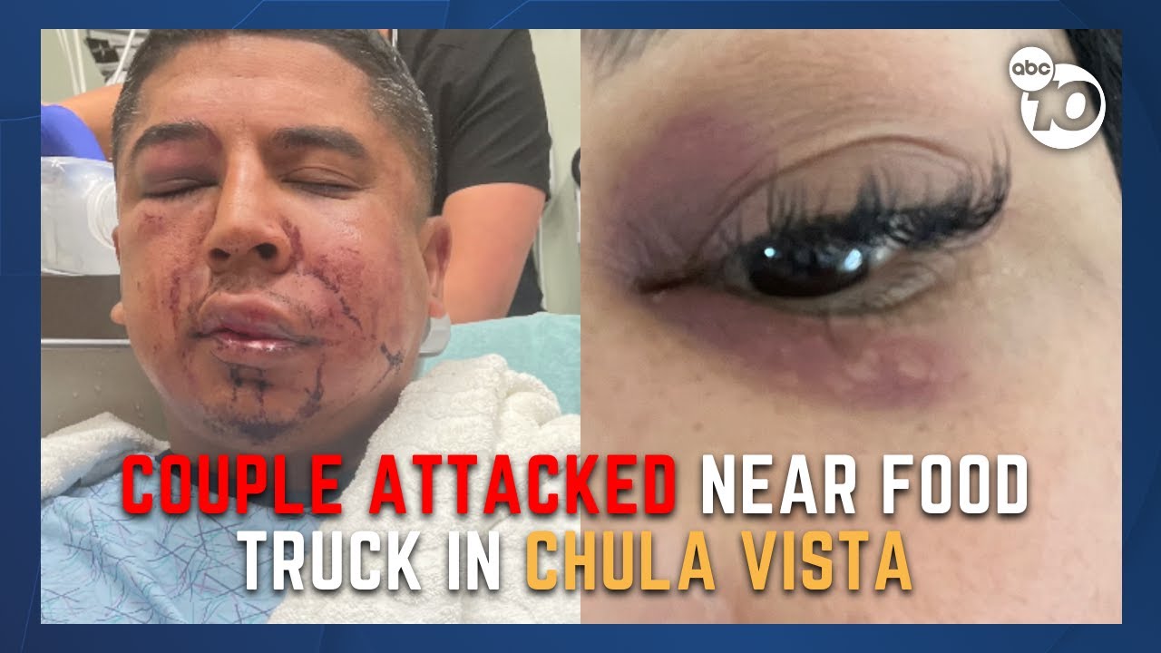 Couple Beaten, Mugged Outside Food Truck In Chula Vista | San Diego News