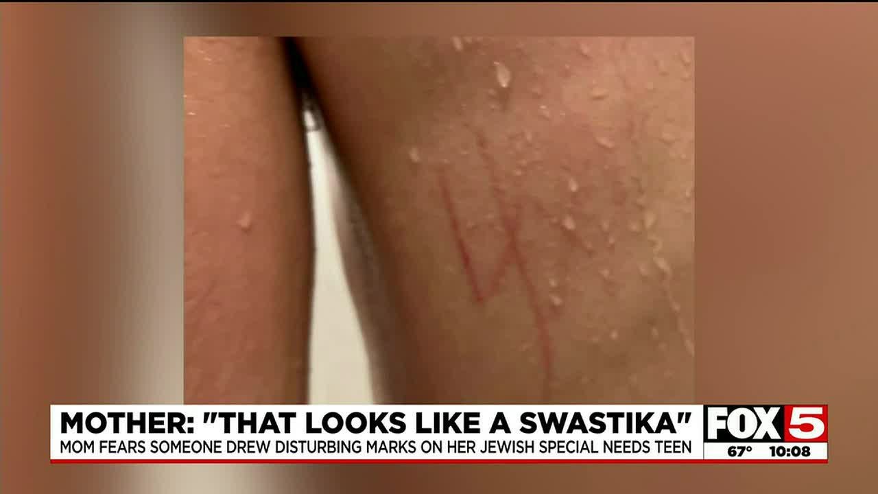 Jewish Community Calls For Answers After Las Vegas Special Needs Teen Had ‘swastika’ On Skin