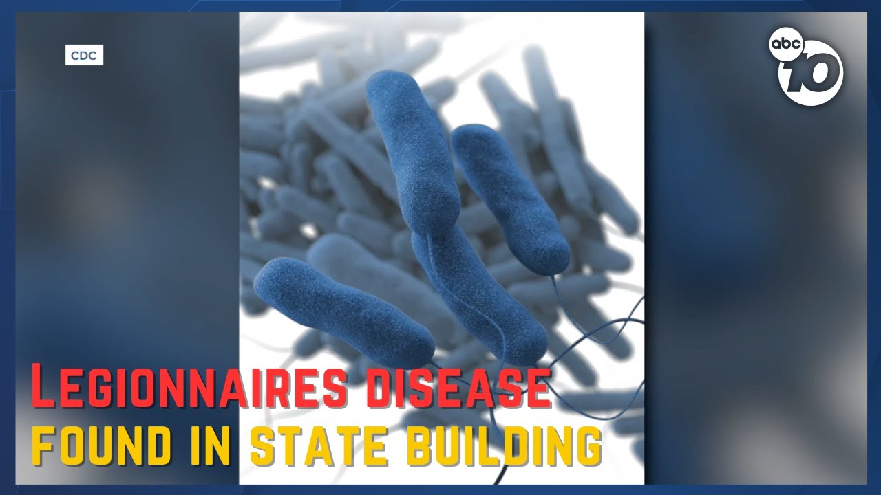 Legionella found in samples taken from state building in Mission Valley | San Diego News