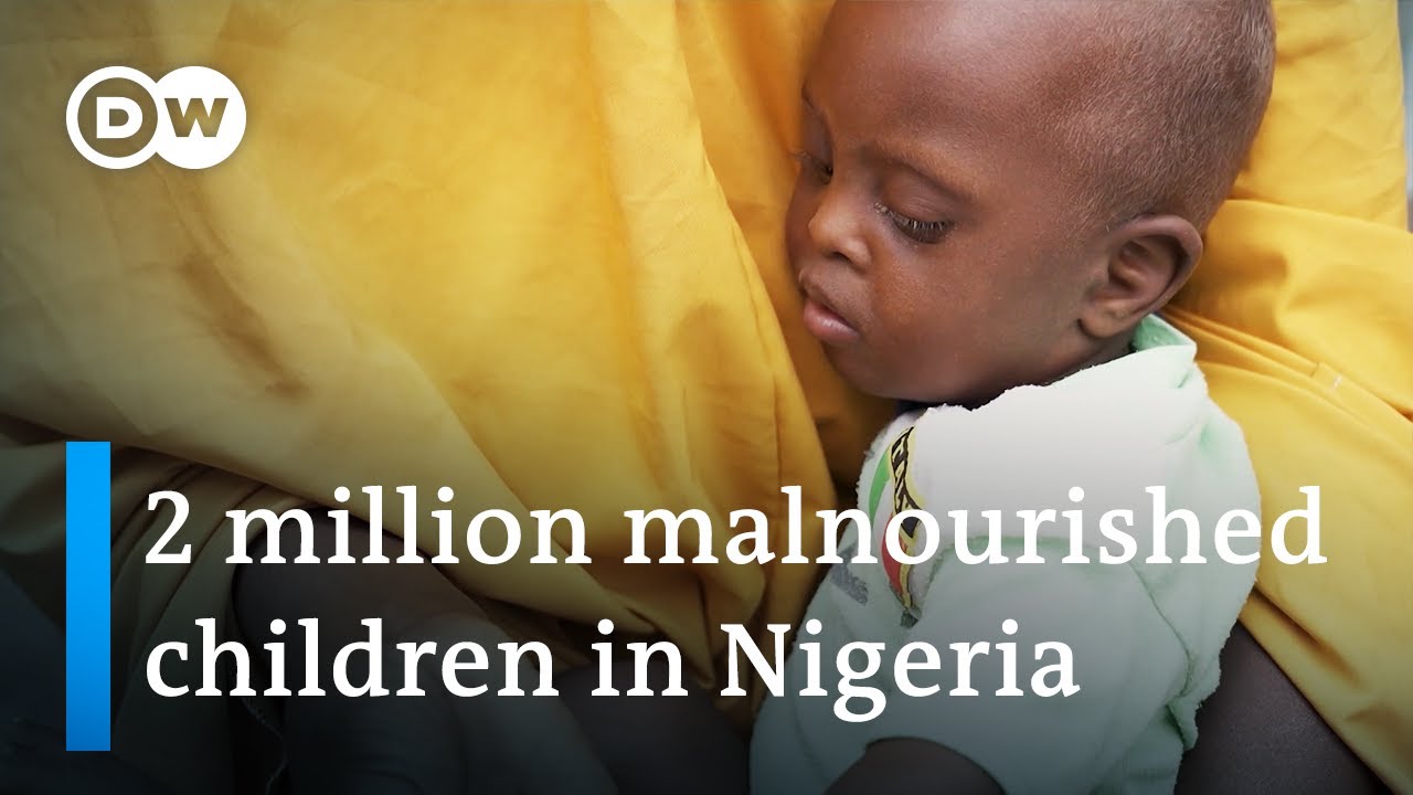 Nigeria Is Battling A Severe Child Malnutrition Crisis | Dw News