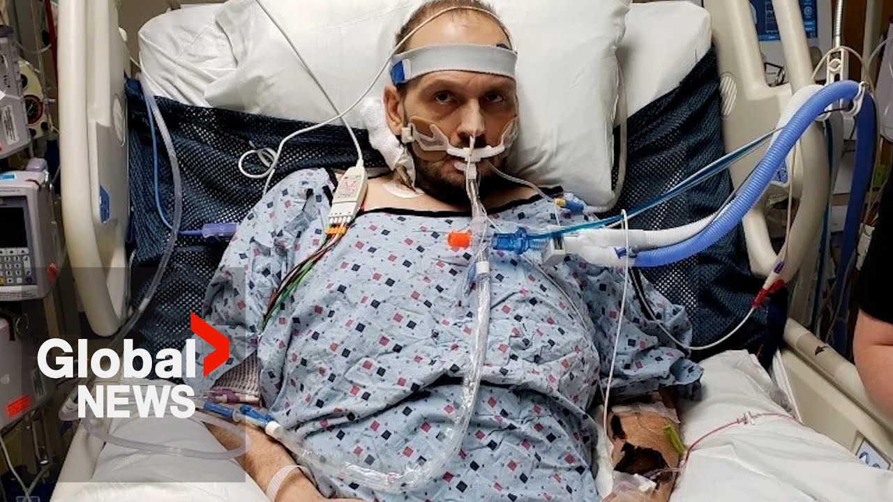 After 4 Flatlines, Saskatoon Father Struggles To Live: “it’s True What They Say About Dying”