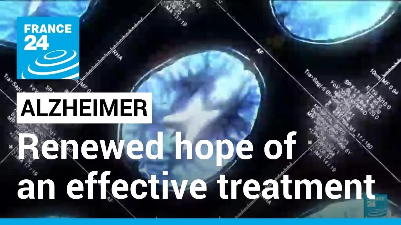 Alzheimer’s Treatment: New Drug Slows Cognitive Decline By 35%, Studies Show • France 24 English