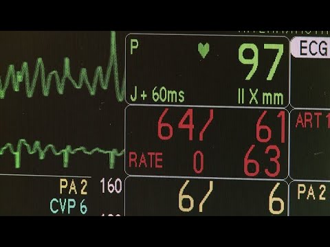 Can Ai Predict A Heart Attack?