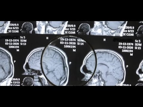 Health Experts Urge Doctors And Parents About Rare Brain Infection