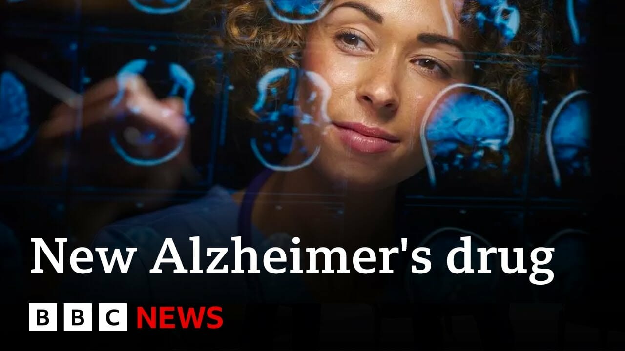 New Alzheimer’s Drug Slows Disease By A Third – Bbc News