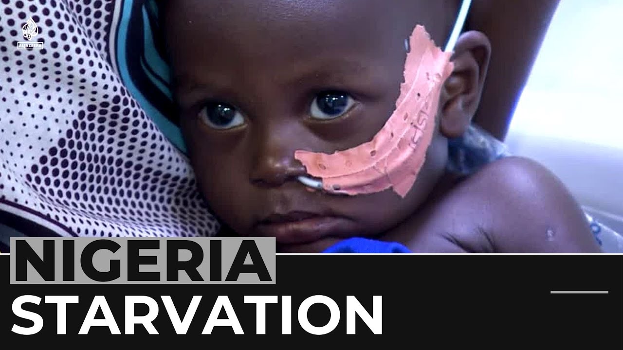 Nigeria Malnutrition: Aid Groups Warn Of Children In Danger