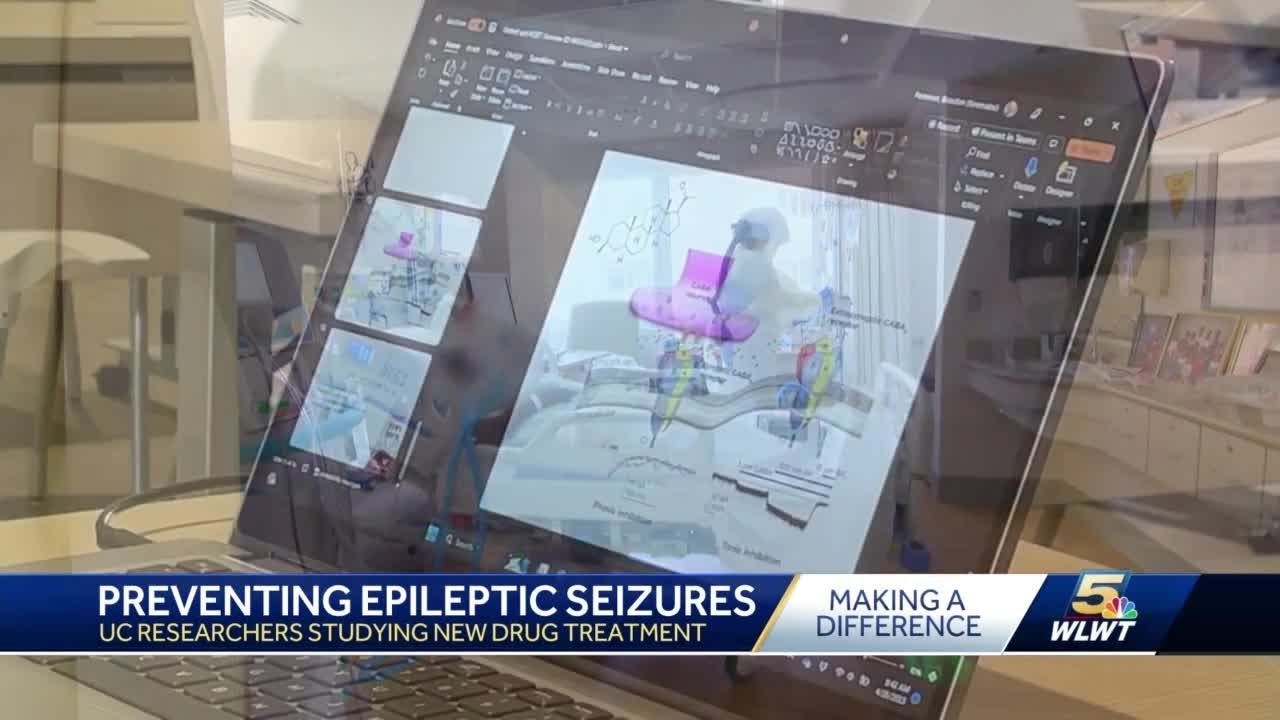 Uc Epilepsy Reset Study One Of 50 Trial Sites Across The Country