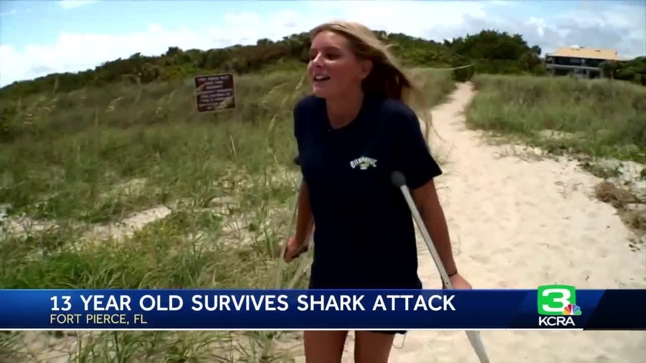 Watch: Florida Teen Describes Being Attacked By A Shark