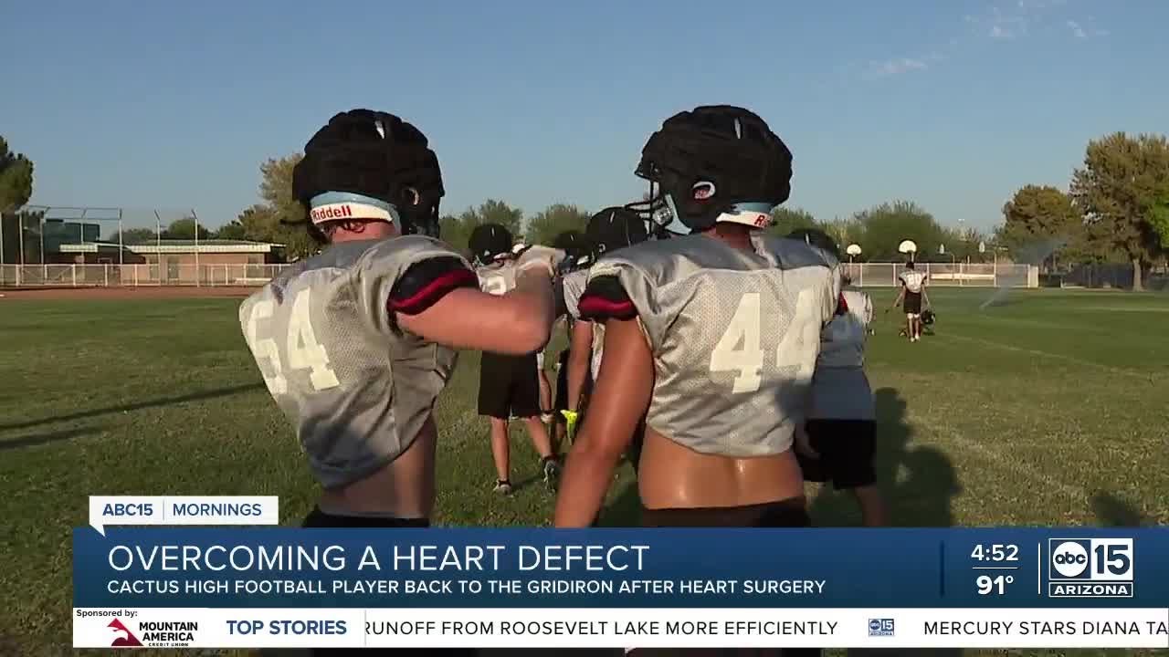 Young Valley Athlete Back On The Field After Heart Surgery